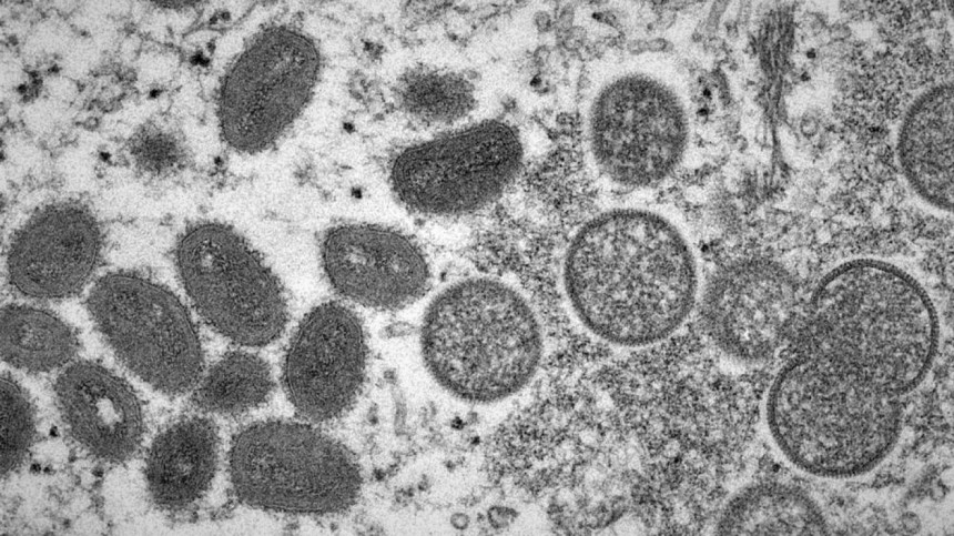 Kerala reports India’s first monkeypox-related death monkeypox death in India