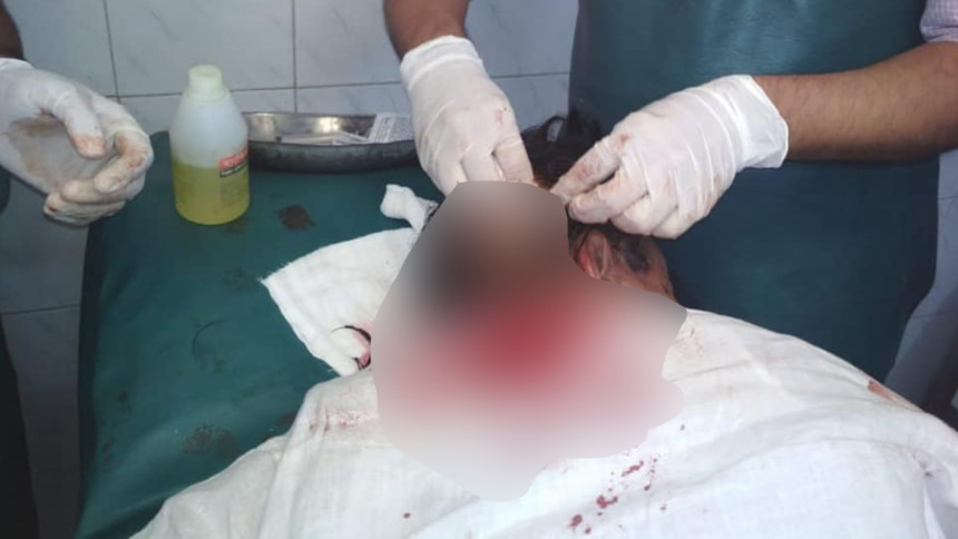 BNP candidate Goyeshwar attacked BNP candidate Goyeshwar attacked