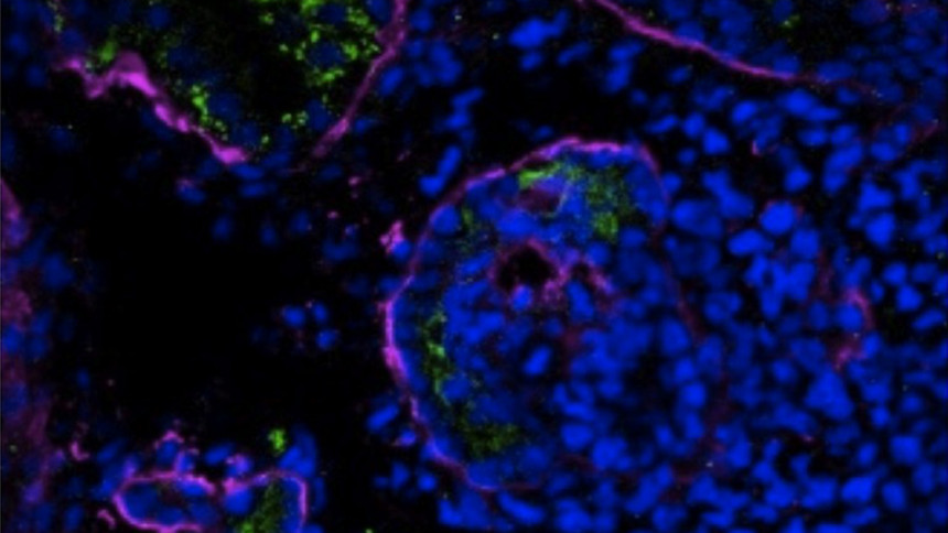 renal tubule cells
